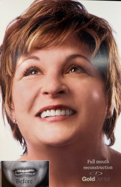 Beautiful cosmetic dentistry result